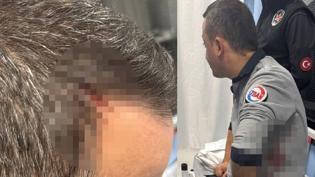 İZBAN'da sigara kavgası: 2 güvenlik görevlisi bıçaklandı
