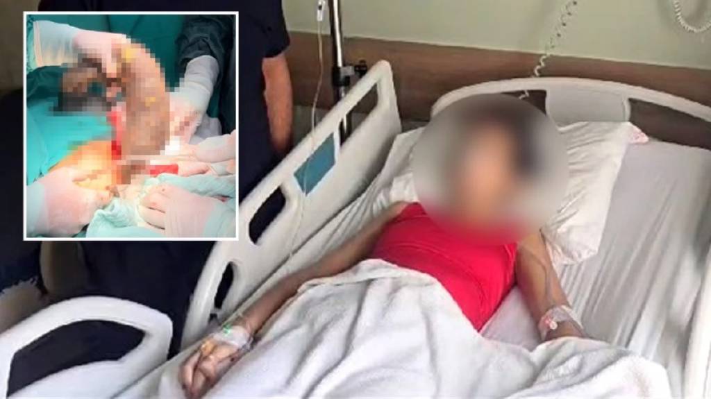 Midesinden çıkana doktorlar bile inanamadı, sebebi sonradan anlaşıldı...