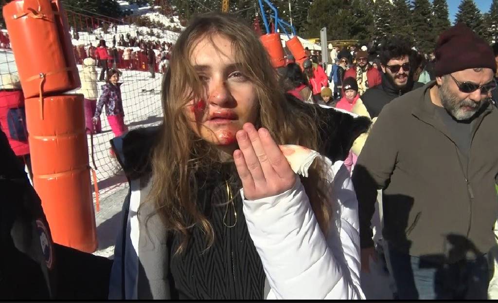 Tıklım tıklım dolunca ‘kaza’ kaçınılmaz oldu… Uludağ’da acemi kayakçılar, birbirine girdi! 
