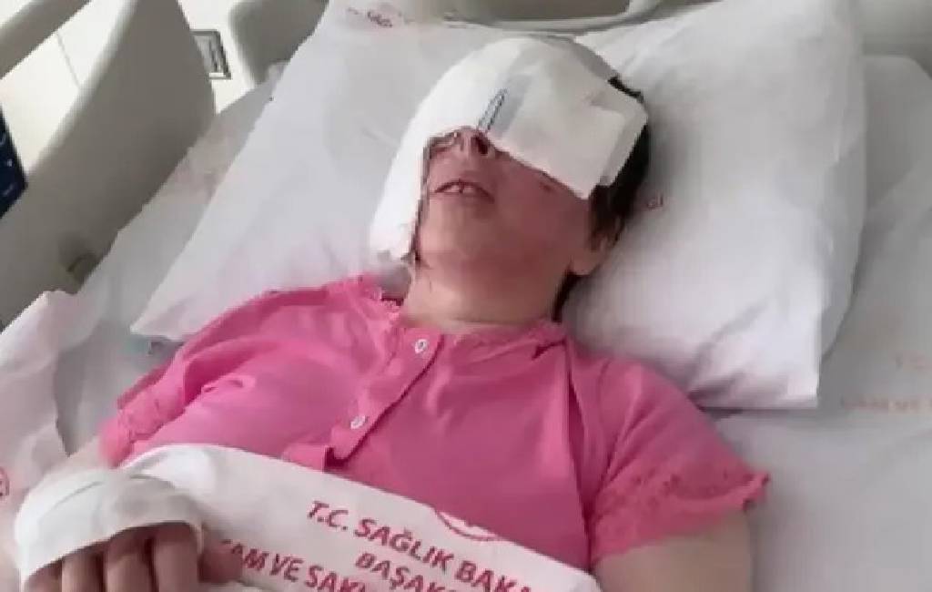 Avcılar'da yüzüne kezzap atılan kadın, kör oldu! ‘Her gün ağlıyorum, gözlerimden kan geliyor’