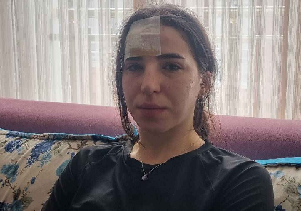Esenyurt’ta başıboş köpekler, bir kadına saldırdı