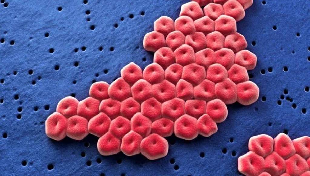 Bilim insanları tespit etti! Antibiyotik dirençli "süper bakteri"