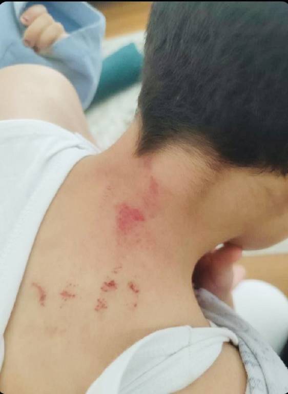 Şanlıurfa’da, öğrencisini darbeden öğretmen tutuklandı!